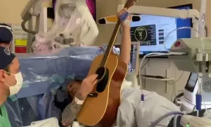 Chơi guitar trong lúc mổ não